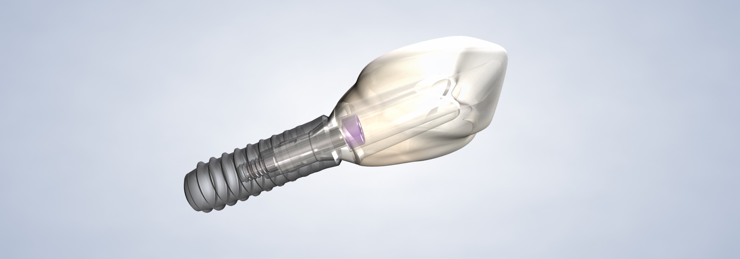 Dental implants in Louisville and Mt. Washington, KY, and Jeffersonville, IN