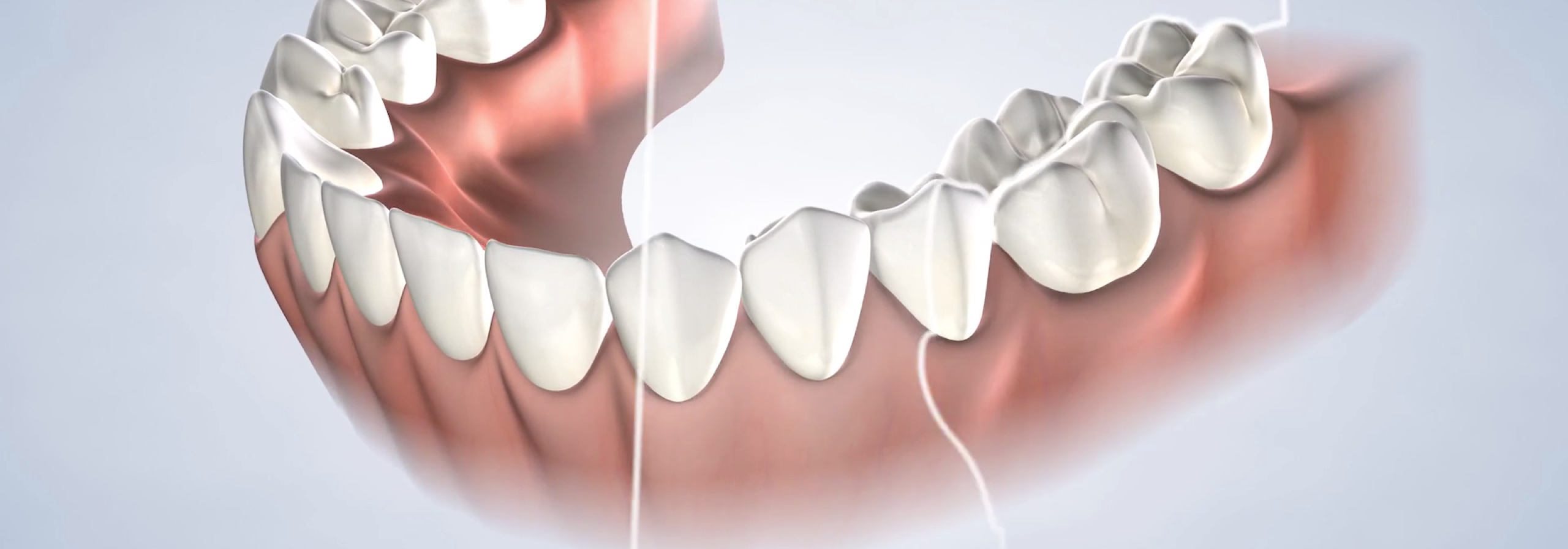 Dental 3d imaging