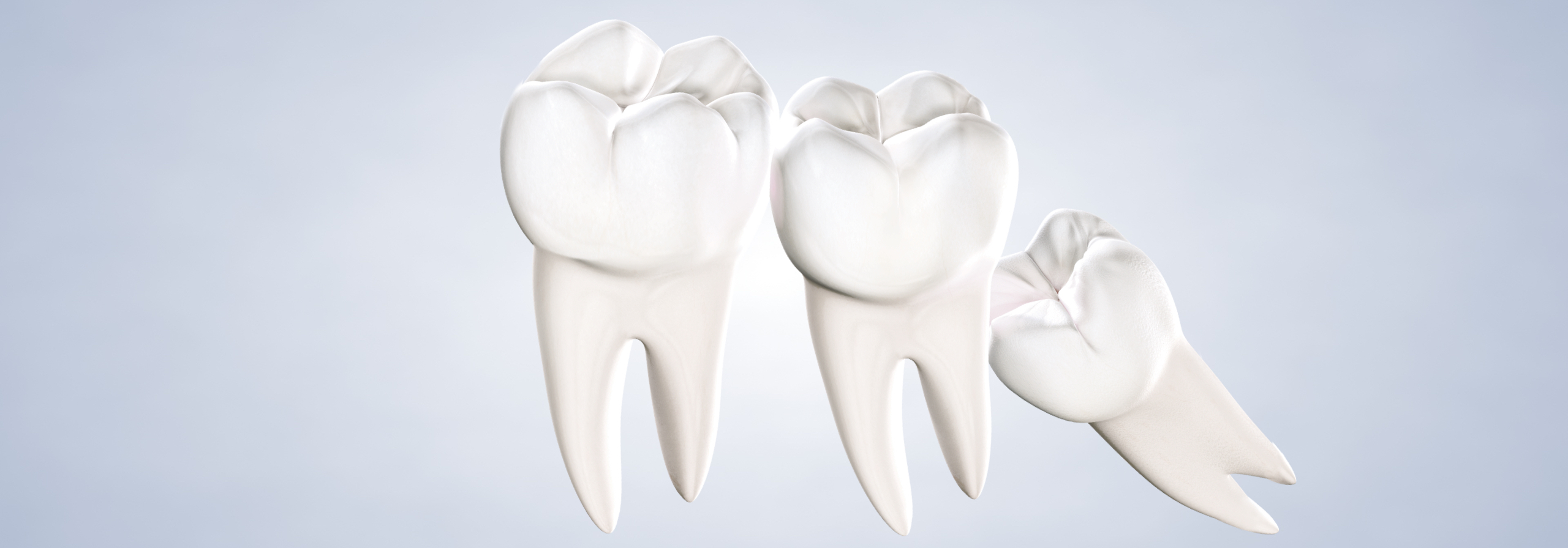 Wisdom teeth removal in Louisville and Mt. Washington, KY, and Jeffersonville, IN